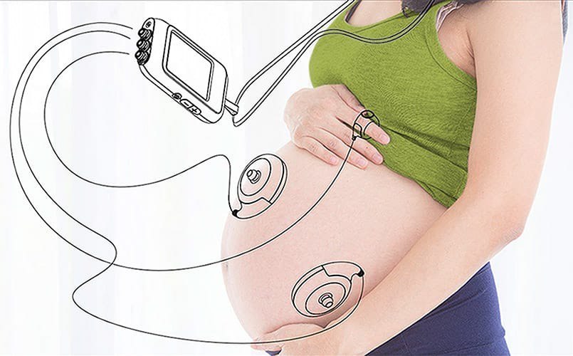 Resident of the SEZ Technopolis Moscow will launch the production of devices for remote pregnancy management